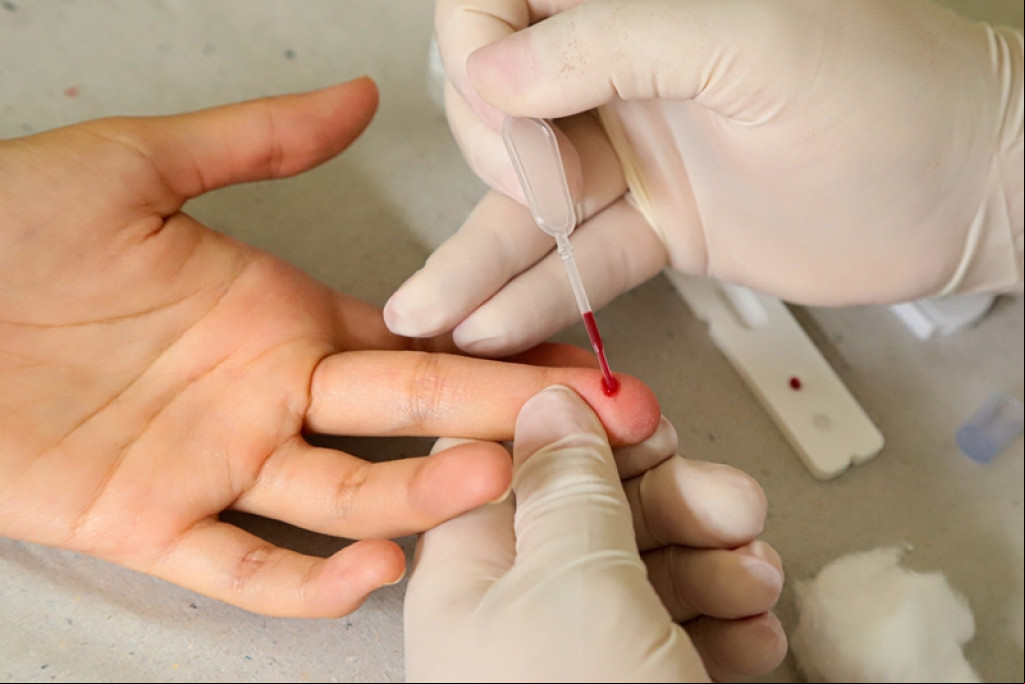 Cidades - Julho Amarelo: segue testagem para detecção de hepatites virais em Santa Bárbara